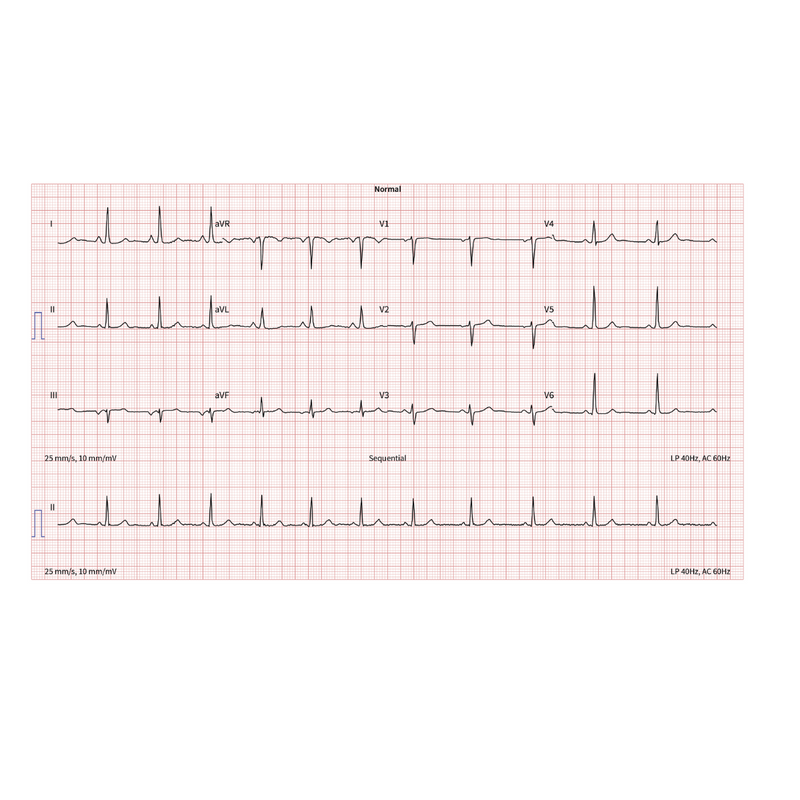 Schiller Cardiovit AT-102 G2 EKG Electrocardiograph  - Perfect for GPs, Clinics and Hospitals. w/Training Included!
