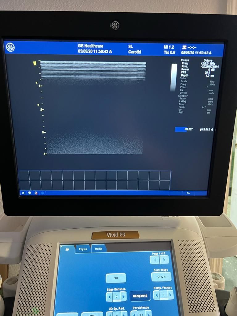 GE Healthcare Vivid E9 Ultrasound Fully Refurbished w/4 Probes