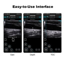 Chison SonoEye P3 HandHeld Ultrasound Advanced phased array