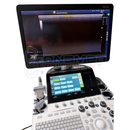 GE Logiq S8 R4 XDclear Ultrasound w/ 3 Probes, Cart based.