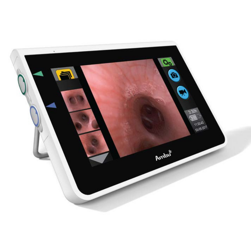 Ambu aView High Resolution Monitor for Ambu® aScope & VivaSight