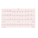 Schiller Cardiovit AT-102 G2 EKG Electrocardiograph  - Perfect for GPs, Clinics and Hospitals. w/Training Included!