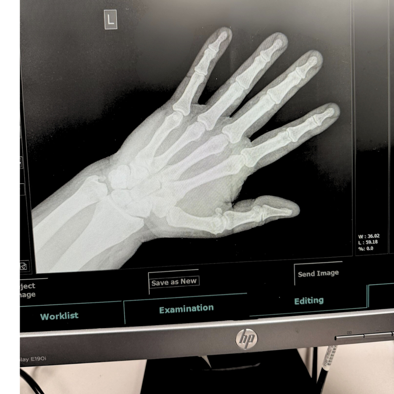 AGFA CR 10-X Computed Radiography CR System. - Refurbished