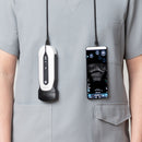 Chison SonoEye P5 HandHeld Ultrasound Convex