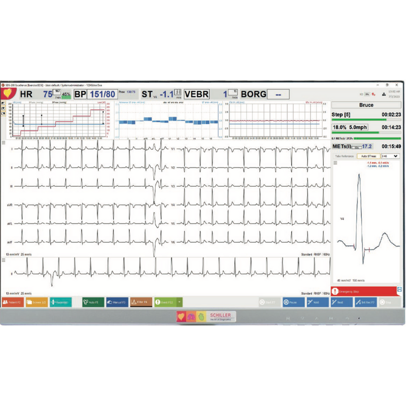 Schiller Cardiovit CS-200 Excellence Stress Test W/INTERPRETATION