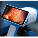 Lutech LT-300 HD Digital Video Colposcope High Definition w/Integrated Display 5/5"