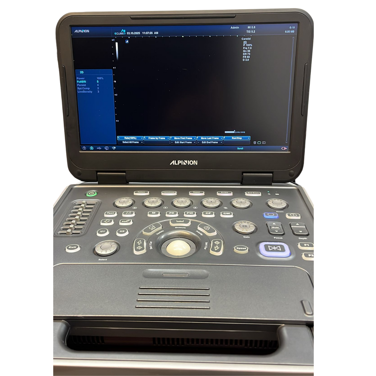 AlpinionECubei7UltrasoundFully