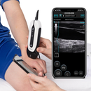 Chison SonoEye P1 HandHeld Linear Ultrasound 30mm