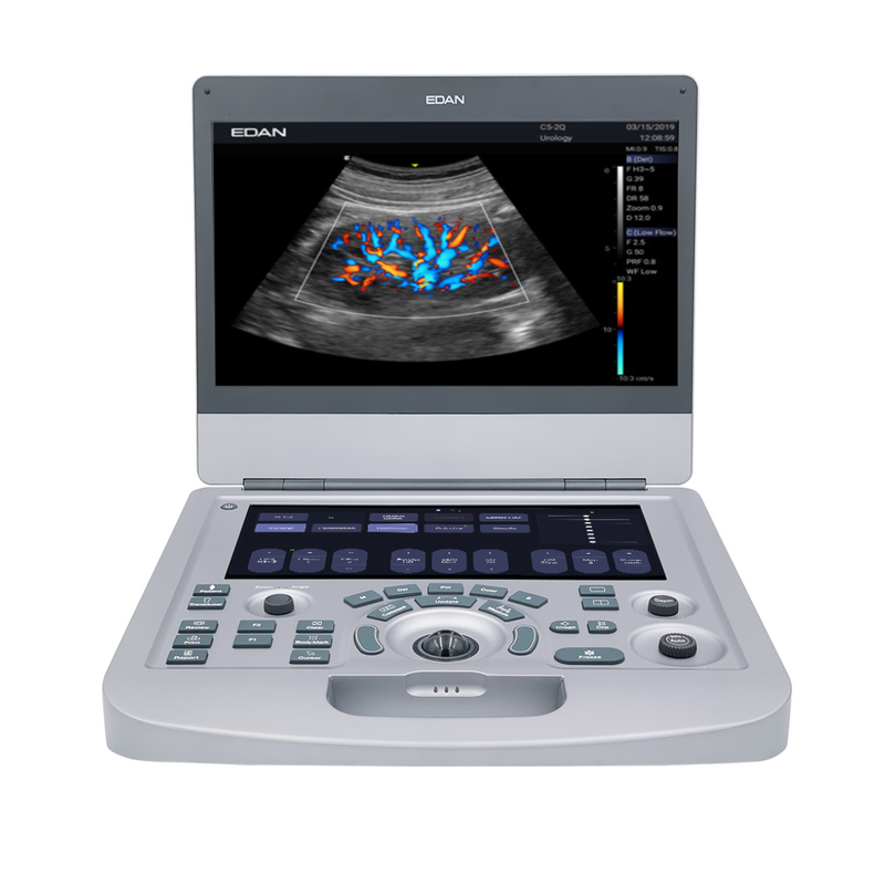 EDAN Acclarix AX2 Compact Ultrasound System (One Transducer Port)