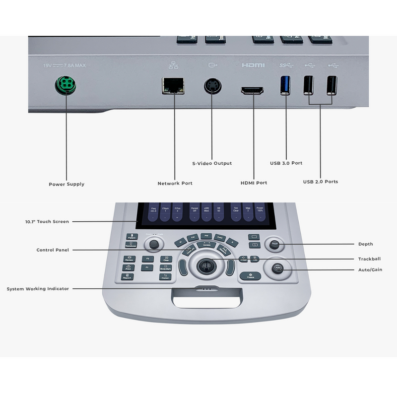 EDAN Acclarix AX3 Compact Ultrasound System (Two Transducer Ports)
