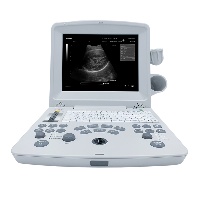 EDAN DUS60 Ultrasound Black & White 12.1" Monitor w/2 Transducers Ports