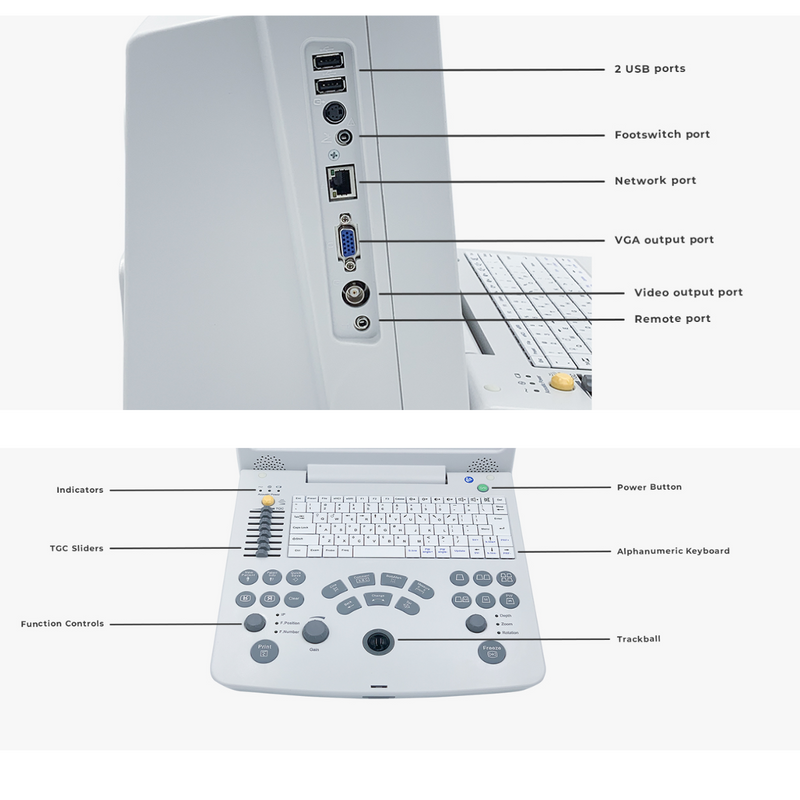 EDAN DUS60 Ultrasound Black & White 12.1" Monitor w/2 Transducers Ports