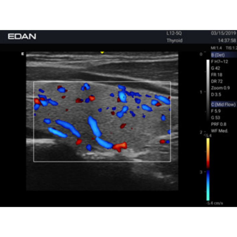 EDAN DUS60 Ultrasound Black & White 12.1" Monitor w/2 Transducers Ports