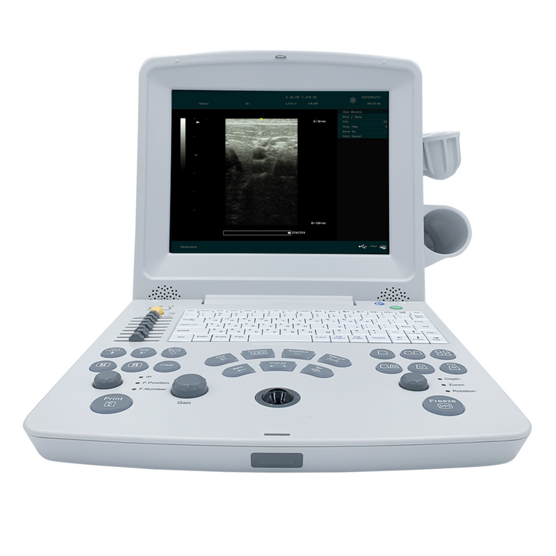 EDAN DUS60 Ultrasound Black & White 12.1" Monitor w/2 Transducers Ports