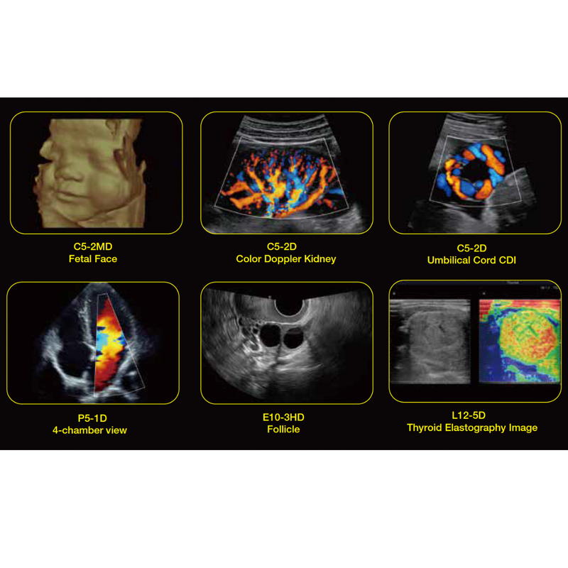 EDAN LX9 Diagnostic Ultrasound Machine w/5 Transducer Ports 21.5-inch LCD Display