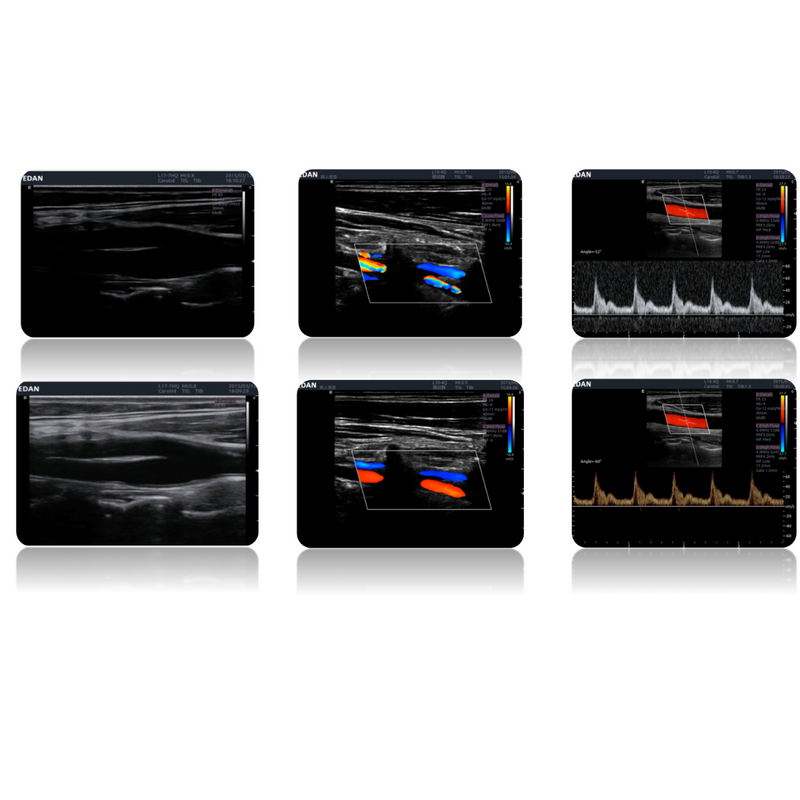 EDAN LX9 Diagnostic Ultrasound Machine w/5 Transducer Ports 21.5-inch LCD Display
