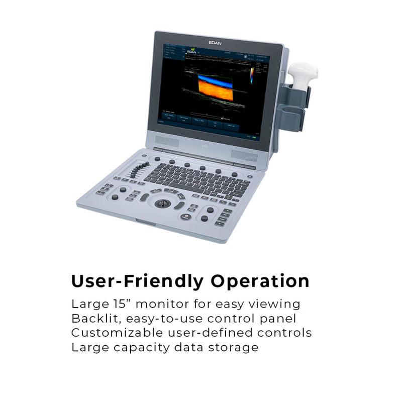 EDAN U60 Ultrasound Color. 15" Monitor w/2 Transducer Ports