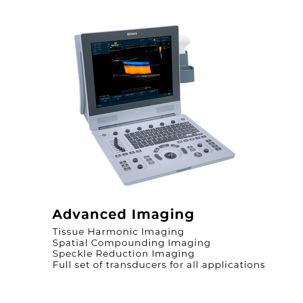 EDAN U60 Ultrasound Color. 15