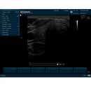 EDAN U60 Ultrasound Color. 15" Monitor w/2 Transducer Ports