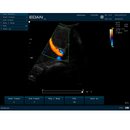 EDAN U60 Ultrasound Color. 15" Monitor w/2 Transducer Ports