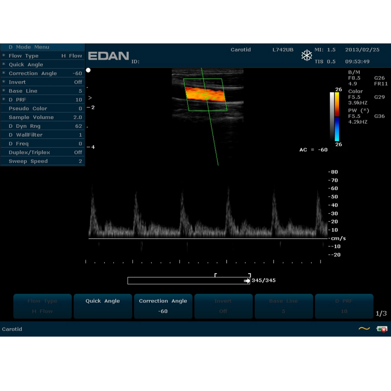 EDAN U60 Ultrasound Color. 15" Monitor w/2 Transducer Ports