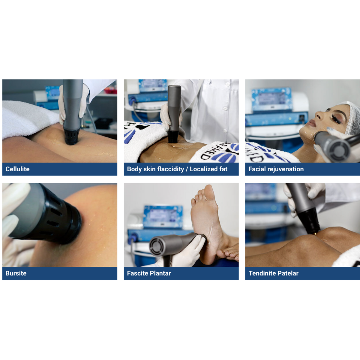 Ibramed Thork Shockwave Therapy Equipment w/Radial Applicator w/+30 Pr