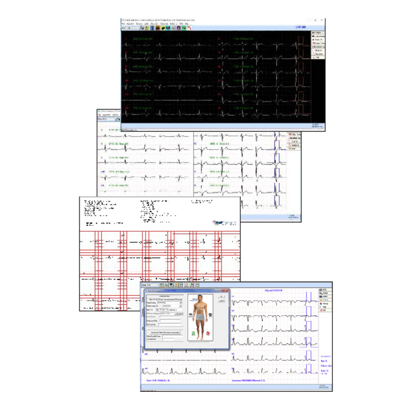 Nassiff CardioResting™ System PC Based Resting ECG System - via USB Connection, Bluetooth or Wifi Mobile - EMR Connectivity