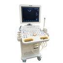 Philips HD7 Ultrasound System – Refurbished with 2 Probes and Printers