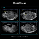 Alpinion ECube i7 Ultrasound Fully Serviced, All Application Open, 3 Probes