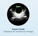 MDPro M2 Bladder Scanner Powered by Peaksonic