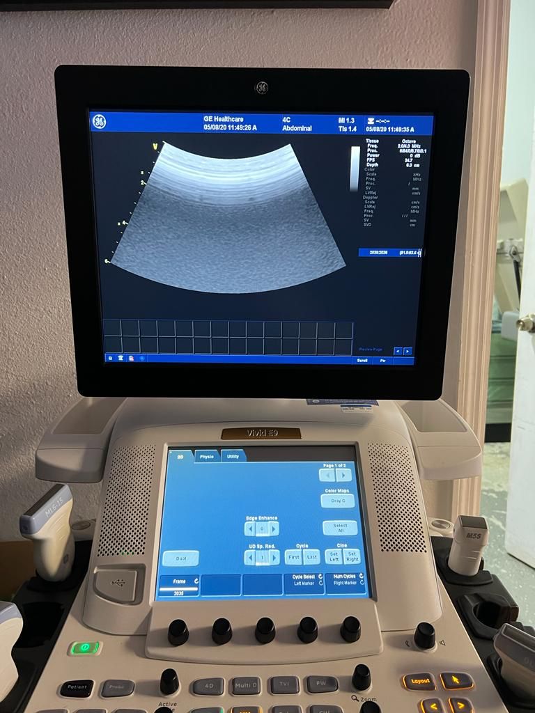 GE Healthcare Vivid E9 Ultrasound Fully Refurbished w/4 Probes