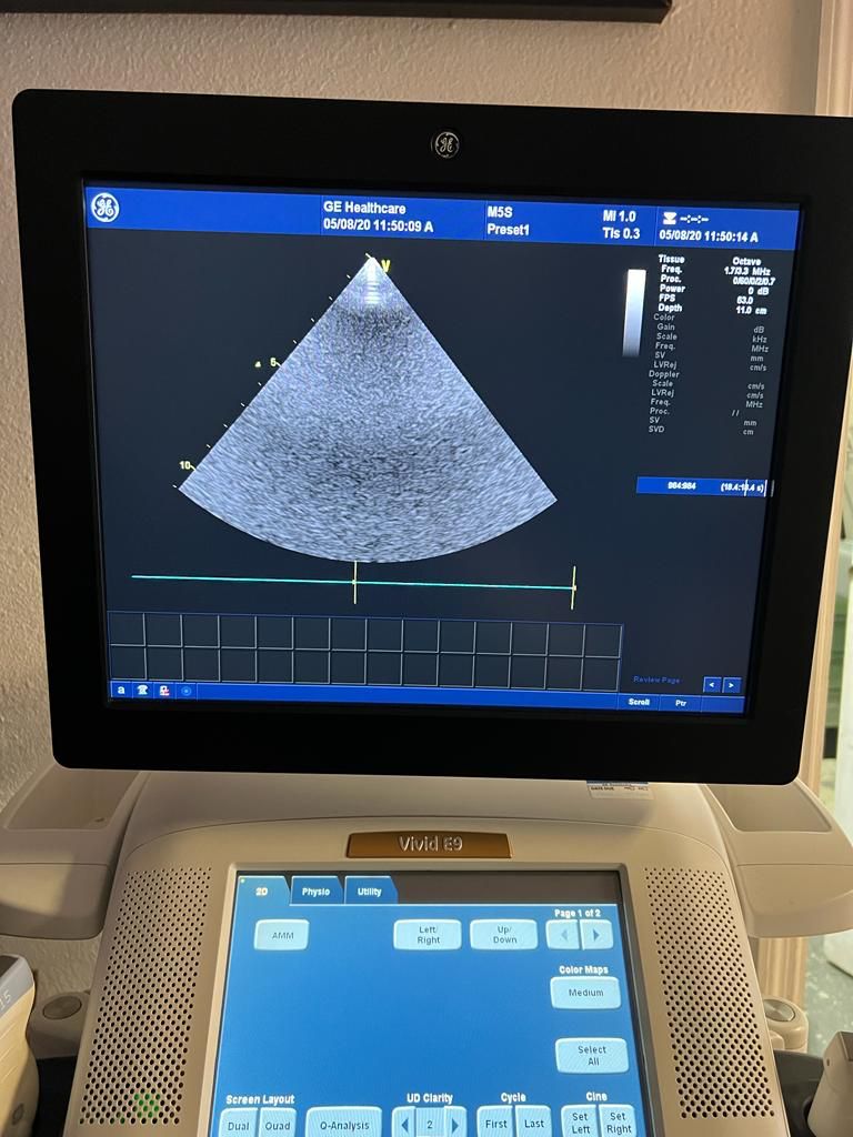 GE Healthcare Vivid E9 Ultrasound Fully Refurbished w/4 Probes