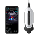 Chison SonoEye P6 HandHeld Ultrasound Micro Convex