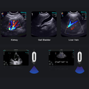 Chison SonoEye P6 HandHeld Ultrasound Micro Convex