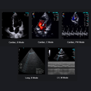 Chison SonoEye P3 HandHeld Ultrasound Advanced phased array