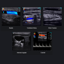 Chison SonoEye P2 HandHeld Linear Ultrasound 40mm