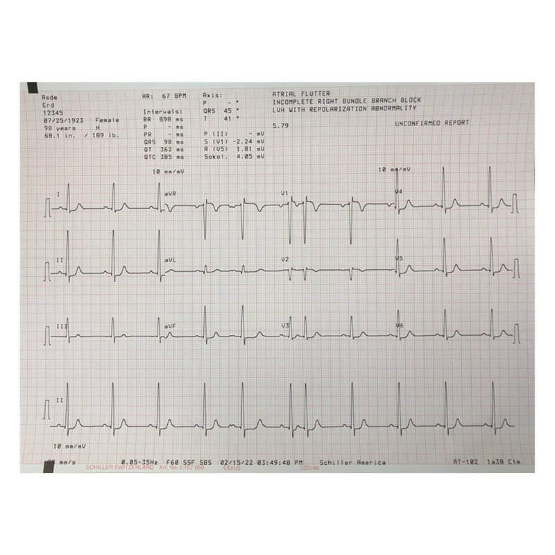 Schiller AT-102 EKG Full Page Print Out