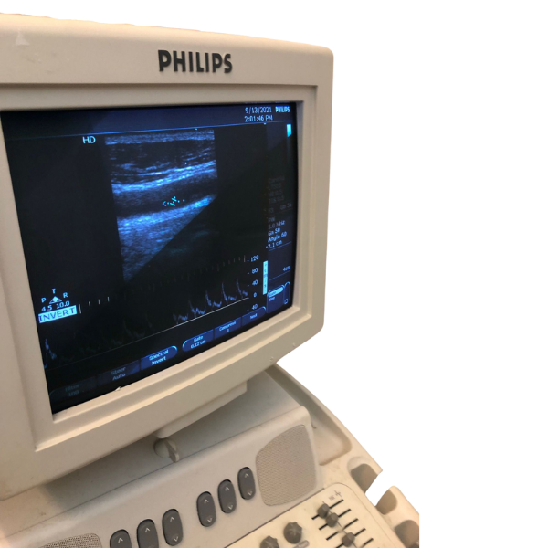 Philips EnVisor Ultrasound - Refurbished - Excellent Conditions