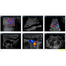 EDAN diagnostic ultrasound system imaging examples for different applications OBGYN 