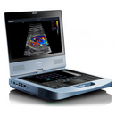 EDAN Acclarix AX7 Ultrasound for diagnositc imaging